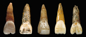 Modified teeth Modified teeth